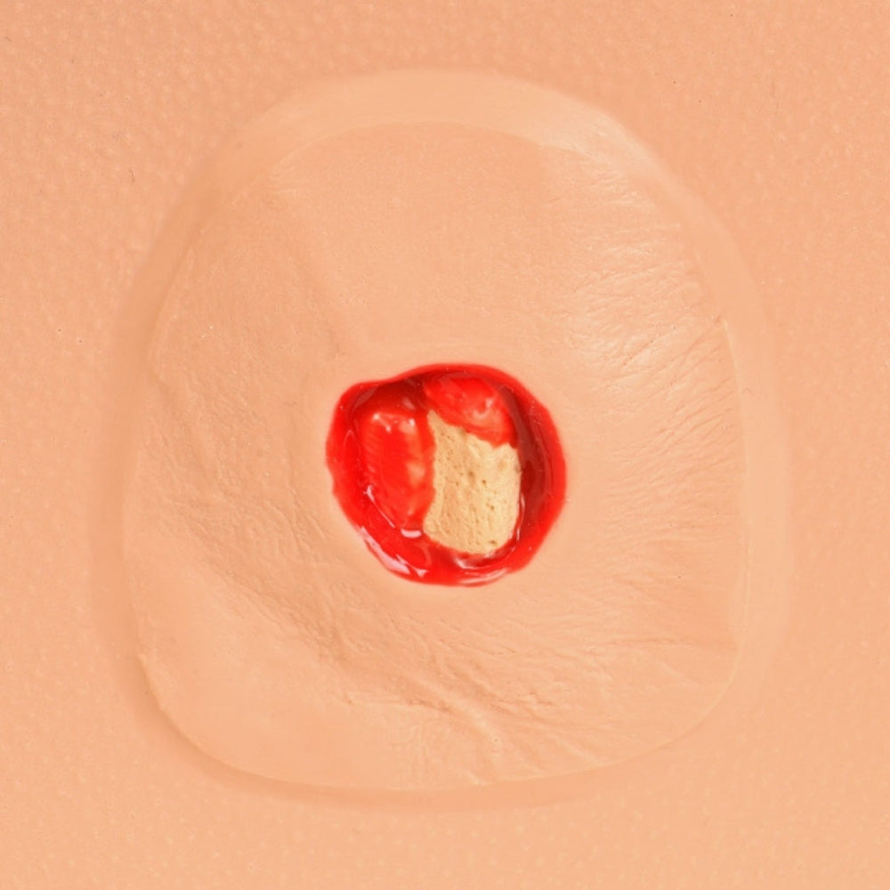 PAT Pressure Injury Staging Model VTA0980 | Sim & Skills