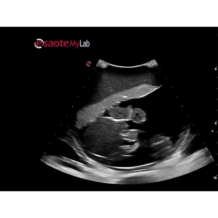 Percutaneous Umbilical Cord Blood Sampling Ultrasound Training Model BP1620 | Sim & Skills