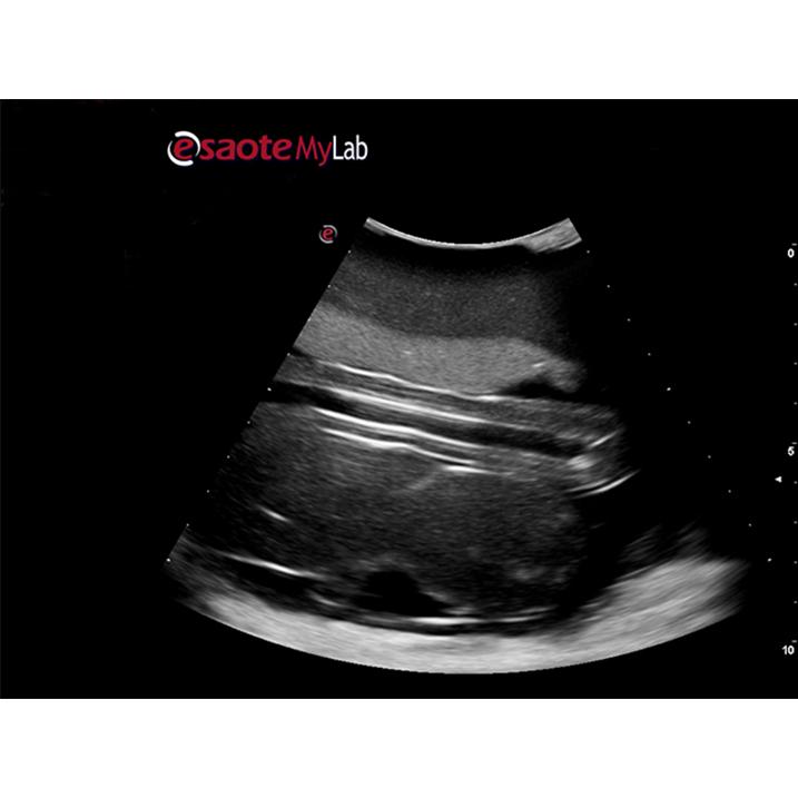 Percutaneous Umbilical Cord Blood Sampling Ultrasound Training Model BP1620 | Sim & Skills