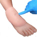 Pitting Oedema Pads for Feet P-OG-001-B | Sim & Skills