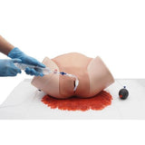 Postpartum Haemorrhage Simulator – PPH Trainer P97 PRO 1023727 | Sim & Skills