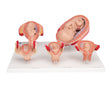 Pregnancy Models Series, 5 Embryo & Foetus Models on a Base 1018633 | Sim & Skills