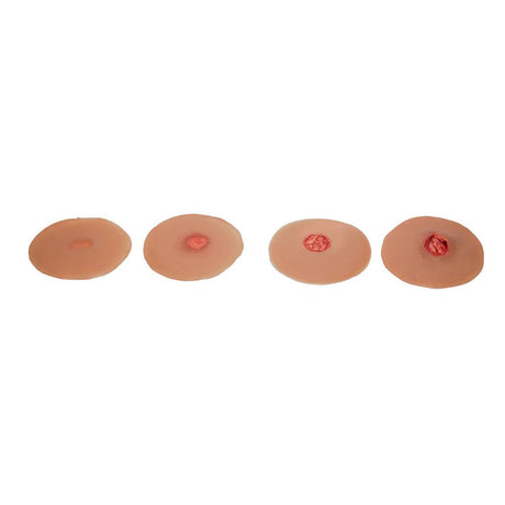 Pressure Ulcer Sticky Wound Kit P-PSCK4-001-M | Sim & Skills