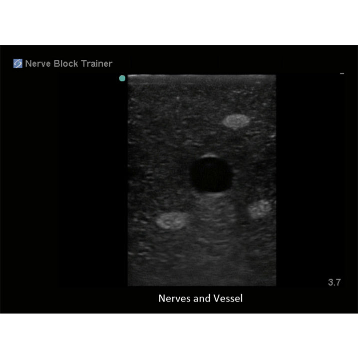 Regional Anaesthesia Ultrasound Training Block Model BPNB150 | Sim & Skills