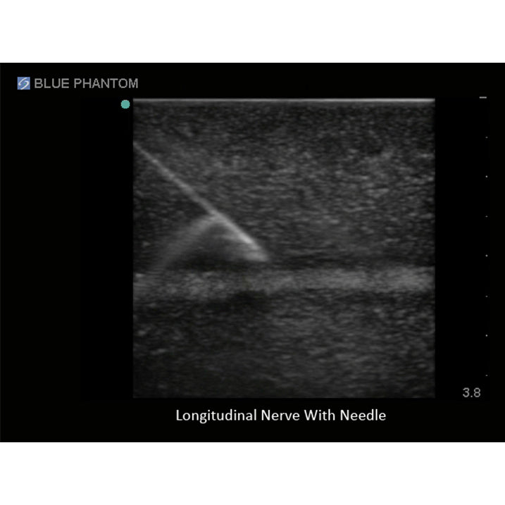 Regional Anaesthesia Ultrasound Training Block Model BPNB150 | Sim & Skills