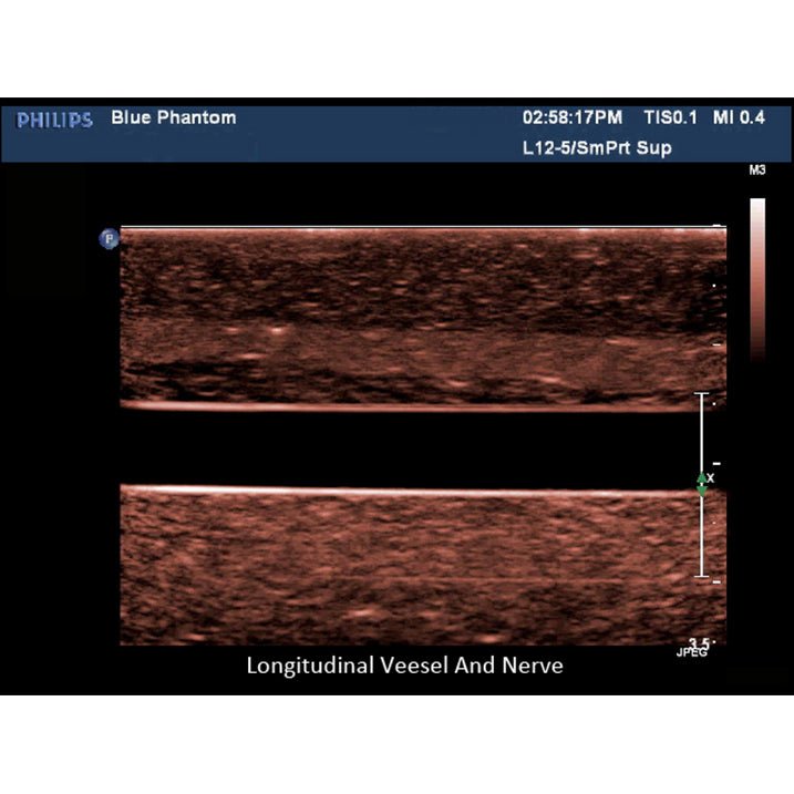 Regional Anaesthesia Ultrasound Training Block Model BPNB150 | Sim & Skills