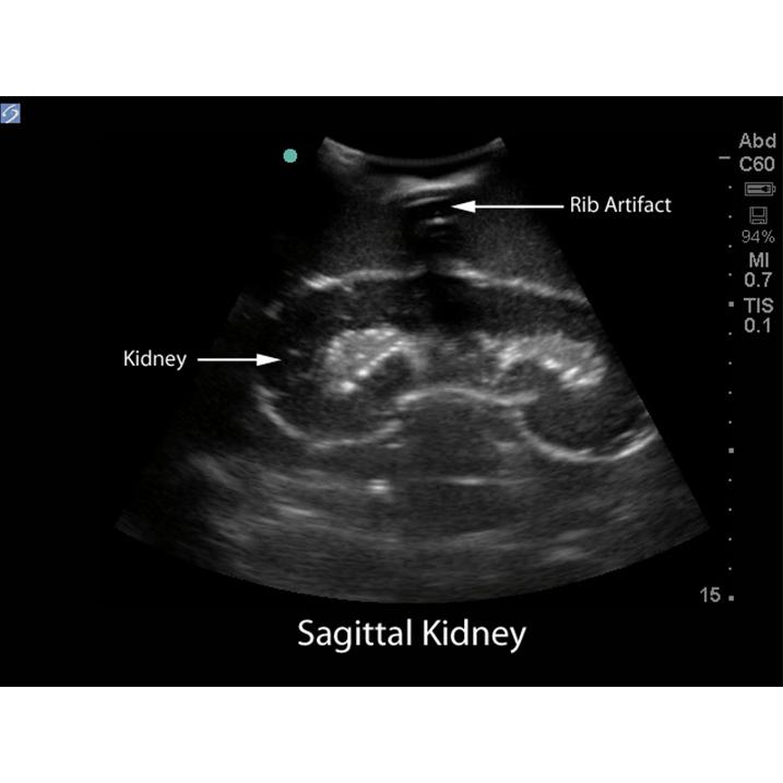 Renal Biopsy Ultrasound Training Model BPRB-2011 | Sim & Skills