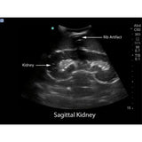 Renal Biopsy Ultrasound Training Model BPRB-2011 | Sim & Skills