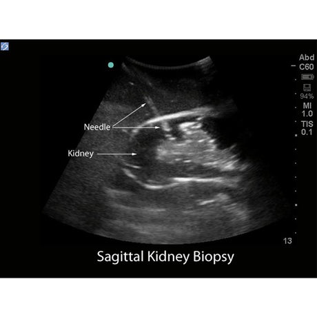 Renal Biopsy Ultrasound Training Model BPRB-2011 | Sim & Skills