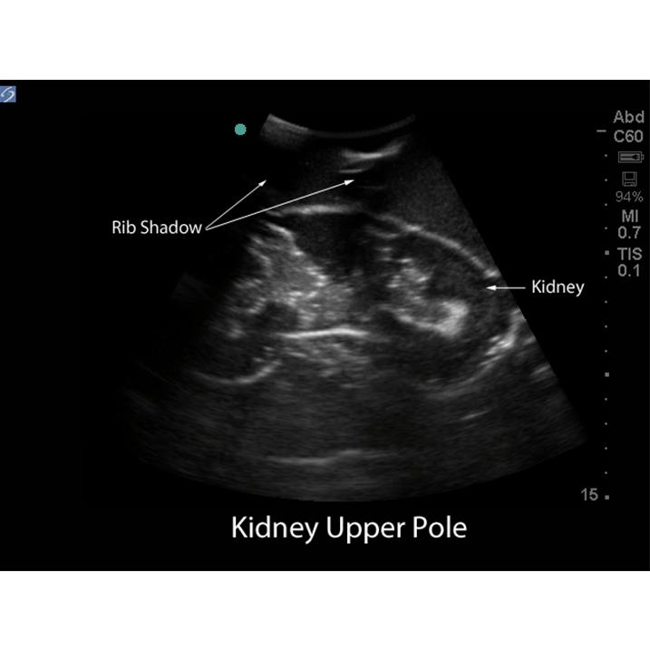 Renal Biopsy Ultrasound Training Model BPRB-2011 | Sim & Skills