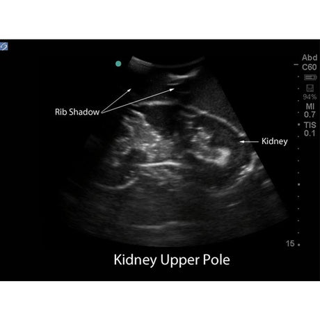 Renal Biopsy Ultrasound Training Model BPRB-2011 | Sim & Skills