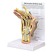 Rheumatoid Arthritis Hand Model 1019521 | Sim & Skills