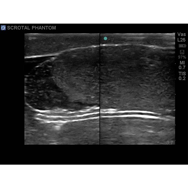 Scrotal Ultrasound Training Model BPS-801 | Sim & Skills