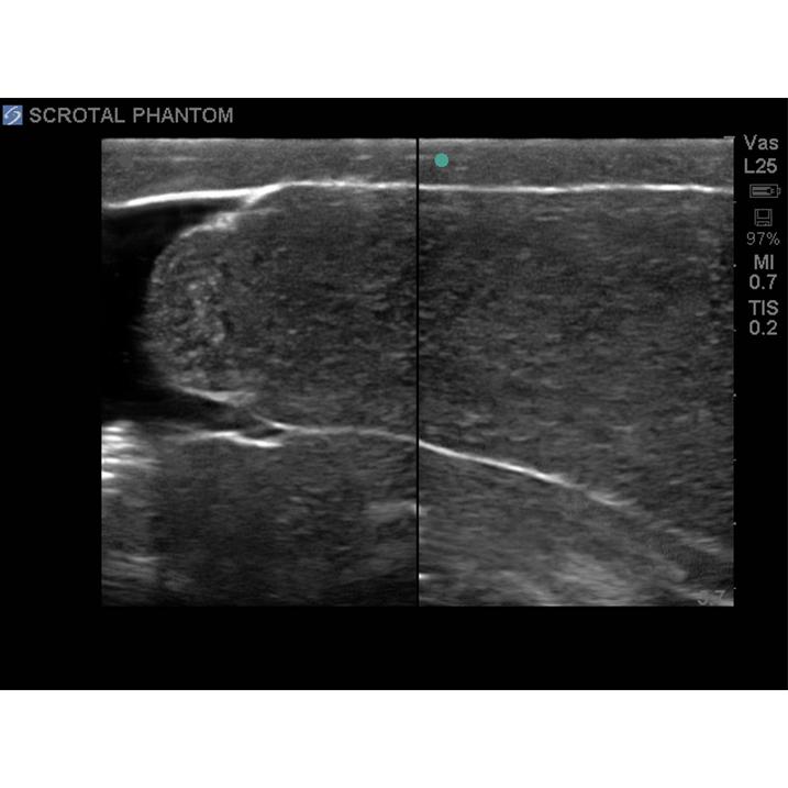 Scrotal Ultrasound Training Model BPS-801 | Sim & Skills