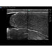 Scrotal Ultrasound Training Model BPS-801 | Sim & Skills