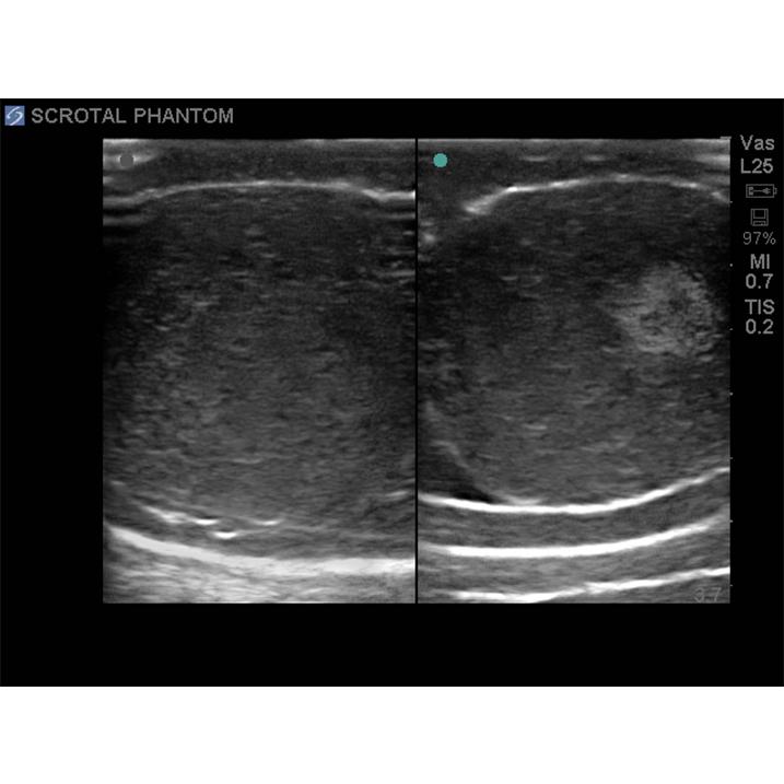 Scrotal Ultrasound Training Model BPS-801 | Sim & Skills