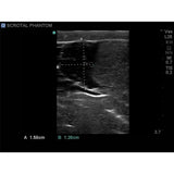 Scrotal Ultrasound Training Model BPS-801 | Sim & Skills