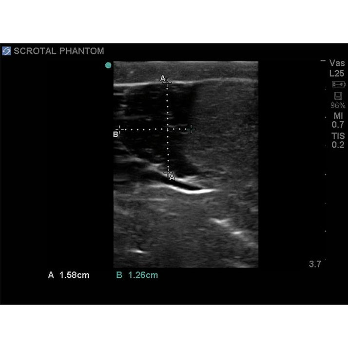 Scrotal Ultrasound Training Model - Sim & Skills