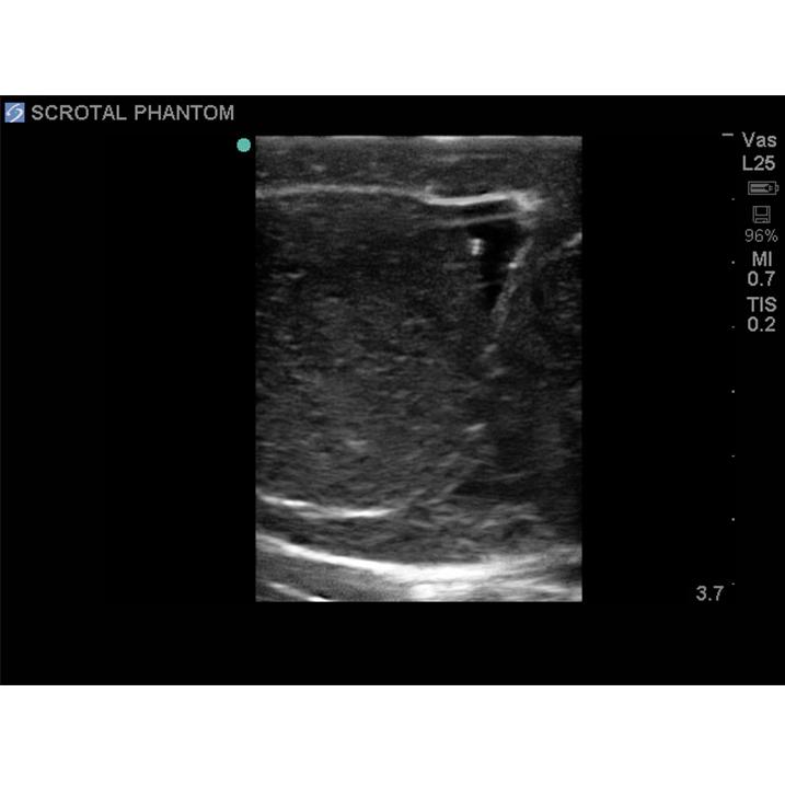 Scrotal Ultrasound Training Model BPS-801 | Sim & Skills