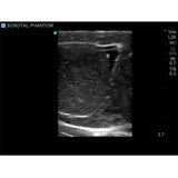 Scrotal Ultrasound Training Model BPS-801 | Sim & Skills