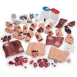 Simulaids® EMT Casualty Simulation Kit 800-818 | Sim & Skills