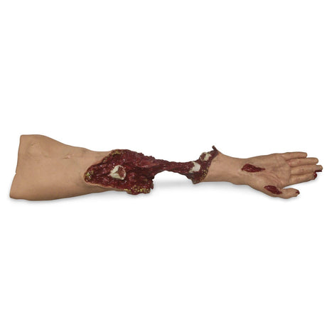 Simulaids® Trauma Moulage Arm 800-642 | Sim & Skills