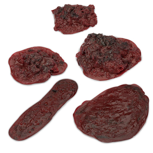 Simulated Blood Clots and Haemorrhages (Set of 5) LF00714 | Sim & Skills