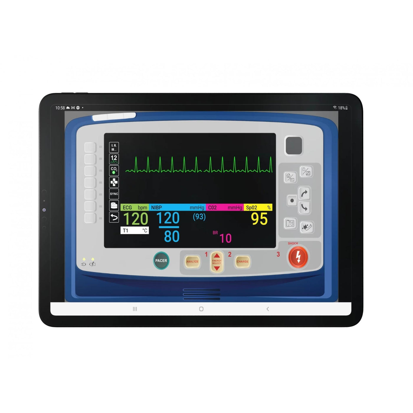 SimVS Simulated Patient Monitor Software - Sim & Skills