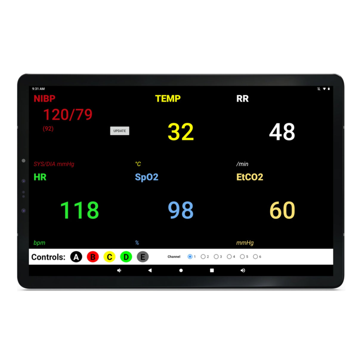 SimVS Simulated Patient Monitor SB53226 | Sim & Skills