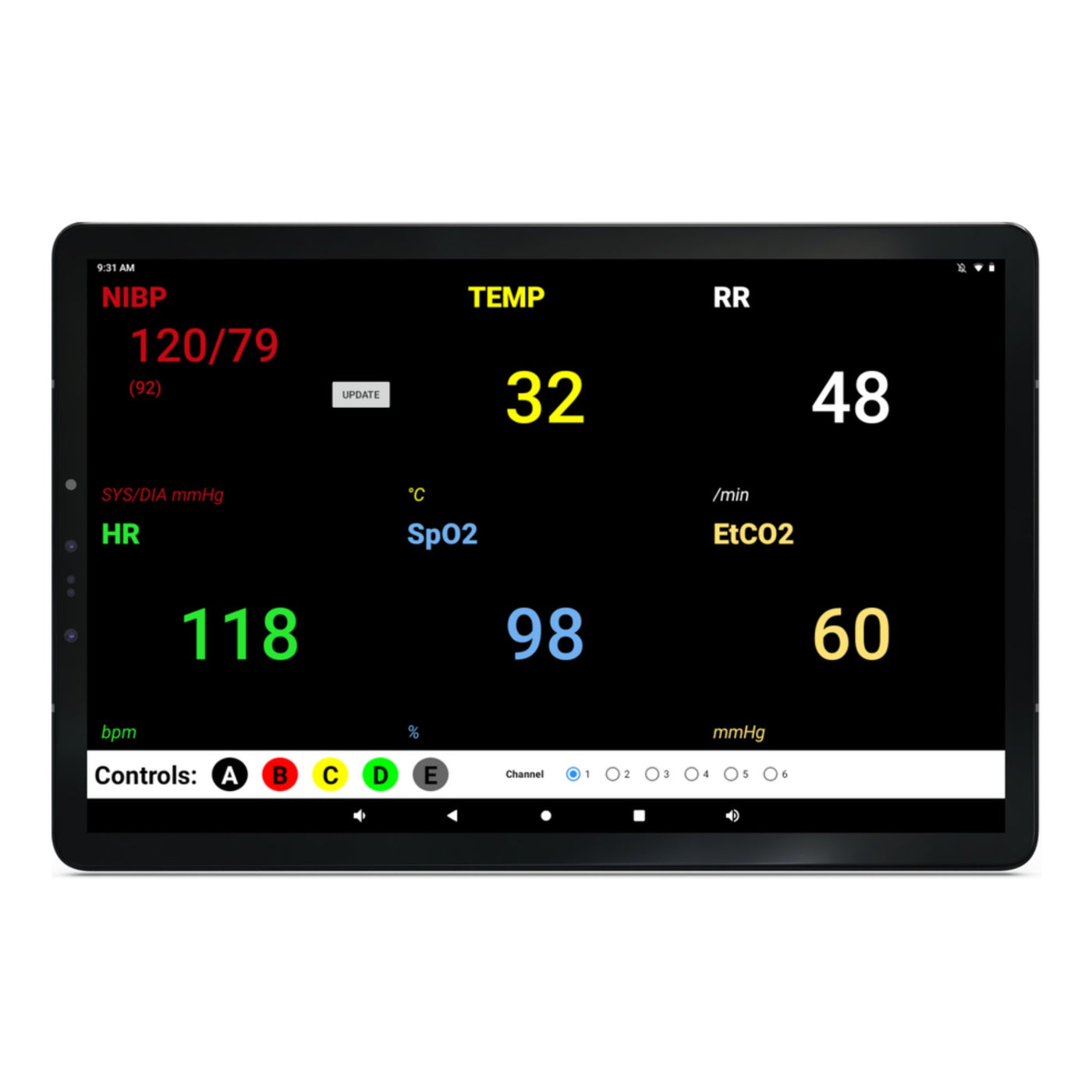 Monitoring Sim Tools SimVS Simulated Patient Monitor Software - Sim & Skills