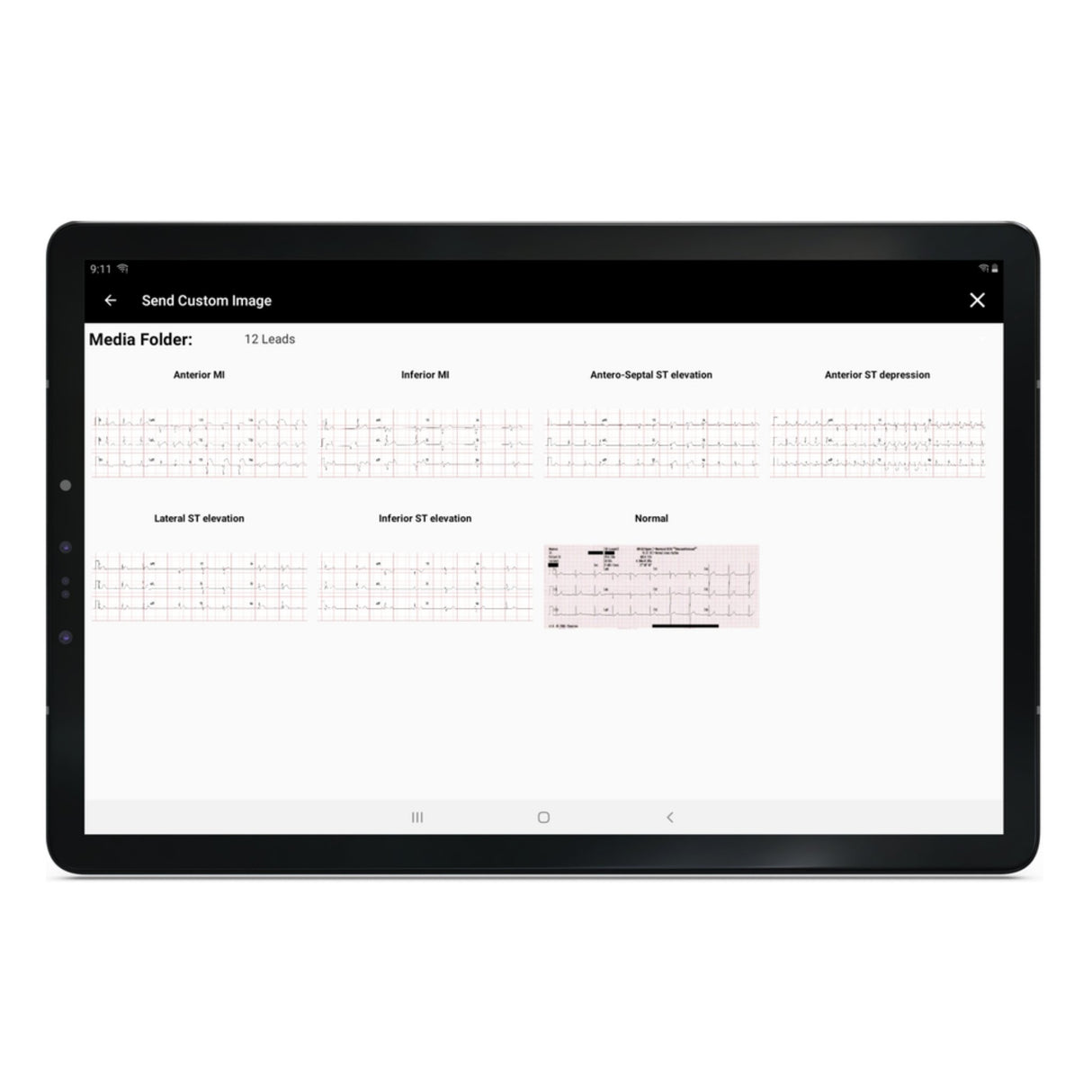 SimVS Simulated Patient Monitor SB53226 | Sim & Skills