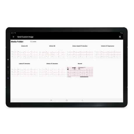 SimVS Simulated Patient Monitor SB53226 | Sim & Skills