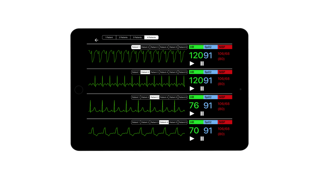 SimVS Simulated Patient Monitor SB53226 | Sim & Skills