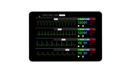 SimVS Simulated Patient Monitor SB53226 | Sim & Skills