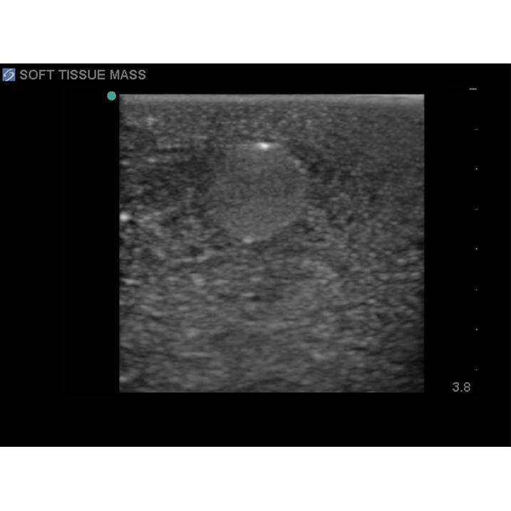 Soft Tissue Biopsy Ultrasound Training Block Model BPTM130 | Sim & Skills