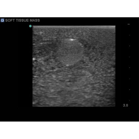 Soft Tissue Biopsy Ultrasound Training Block Model BPTM130 | Sim & Skills