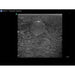Soft Tissue Biopsy Ultrasound Training Block Model BPTM130 | Sim & Skills