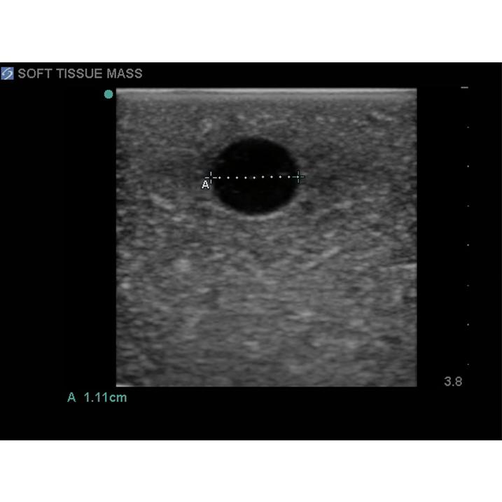 Soft Tissue Biopsy Ultrasound Training Block Model BPTM130 | Sim & Skills