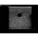 Soft Tissue Biopsy Ultrasound Training Block Model BPTM130 | Sim & Skills