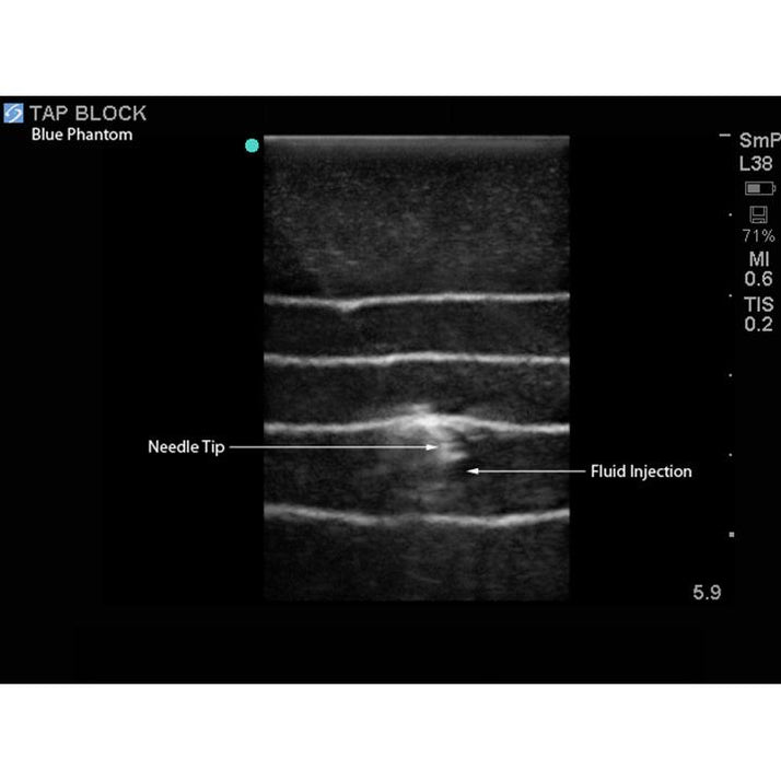 TAP Block Ultrasound Training Model Sim & Skills