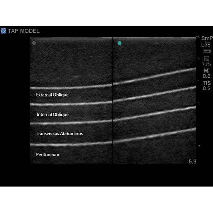 TAP Block Ultrasound Training Model BP2001-TAP | Sim & Skills