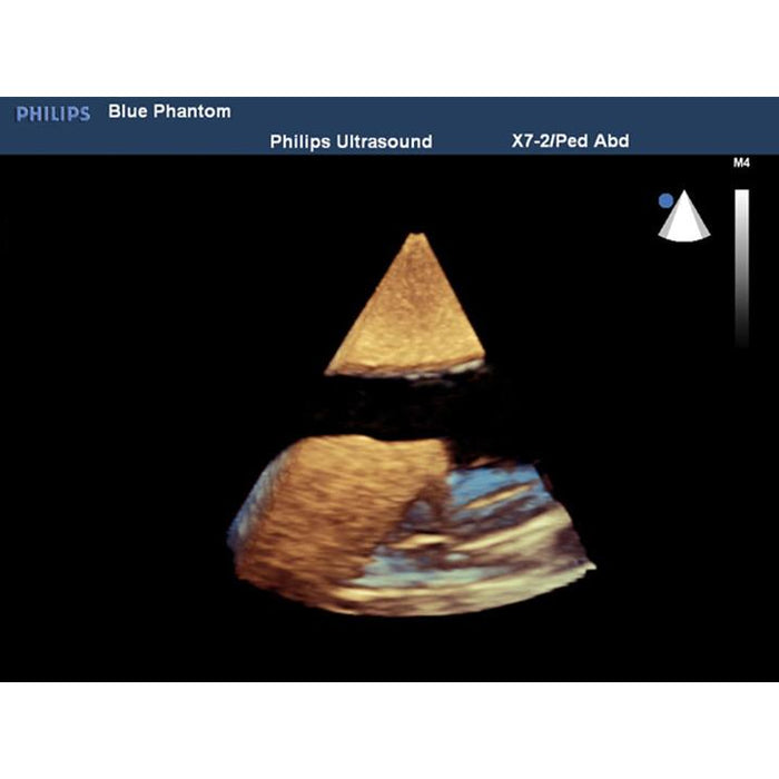 Thoracentesis and Thoracostomy Ultrasound Model BPTT1000-1 | Sim & Skills