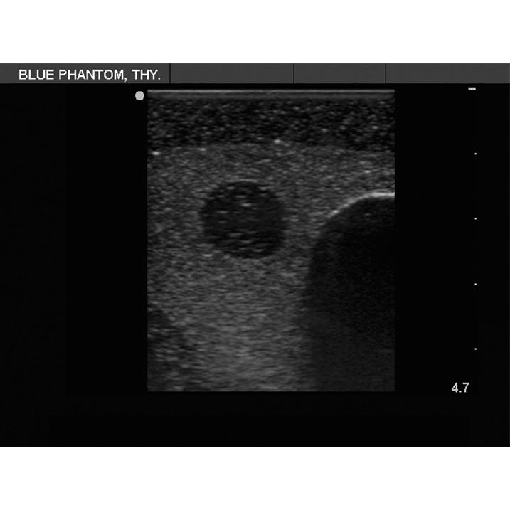 Thyroid Biopsy Ultrasound Training Model BPT195 | Sim & Skills