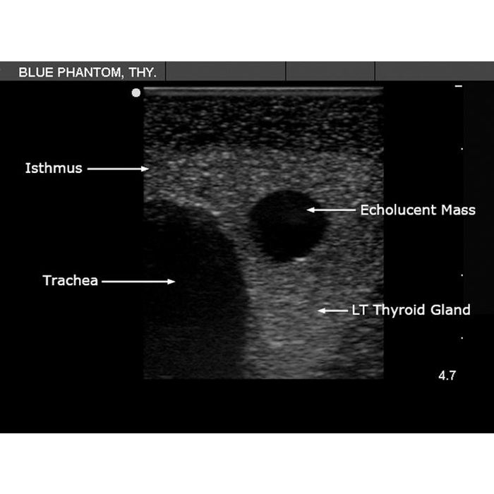 Thyroid Biopsy Ultrasound Training Model BPT195 | Sim & Skills