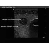 Thyroid Biopsy Ultrasound Training Model BPT195 | Sim & Skills