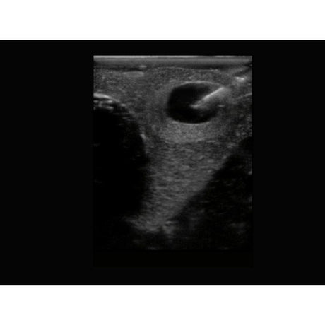 Thyroid Biopsy Ultrasound Training Model BPT195 | Sim & Skills