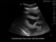 Transoesophageal Echo and Transthoracic Echo Ultrasound Training Model | BP-TEE1702 | Blue Phantom | Sim & Skills
