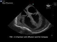 Transoesophageal Echo and Transthoracic Echo Ultrasound Training Model | BP-TEE1702 | Blue Phantom | Sim & Skills