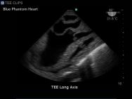 Transoesophageal Echo and Transthoracic Echo Ultrasound Training Model | BP-TEE1702 | Blue Phantom | Sim & Skills