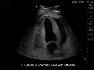 Transoesophageal Echo and Transthoracic Echo Ultrasound Training Model | BP-TEE1702 | Blue Phantom | Sim & Skills